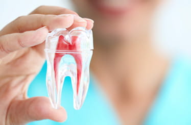 Image of root canal treatment