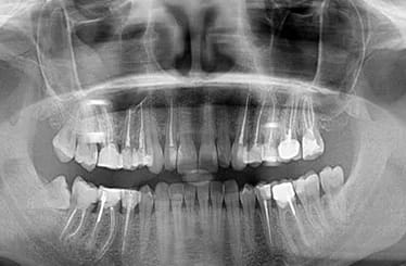 Image of x-rays