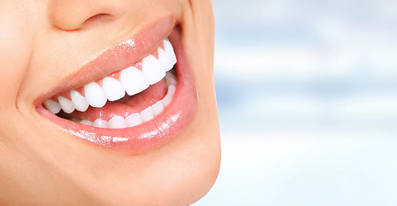 Image of a woman smiling, displaying beautiful teeth
