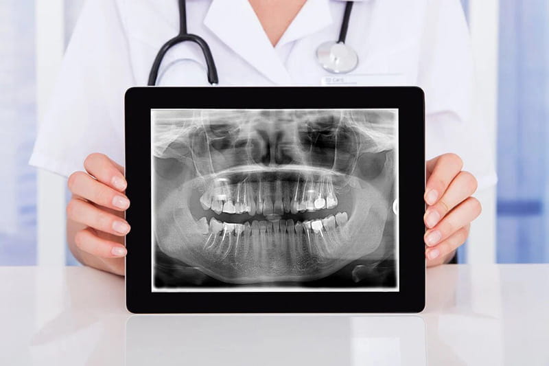 Image of a dentist holding a digital dental X-ray.